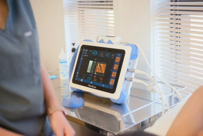 Fibroscan